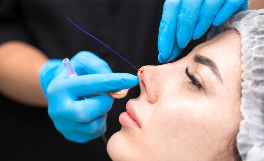 کوچک کردن بینی بدون عمل جراحی کوچک کردن بینی بدون عمل با استفاده از نخ